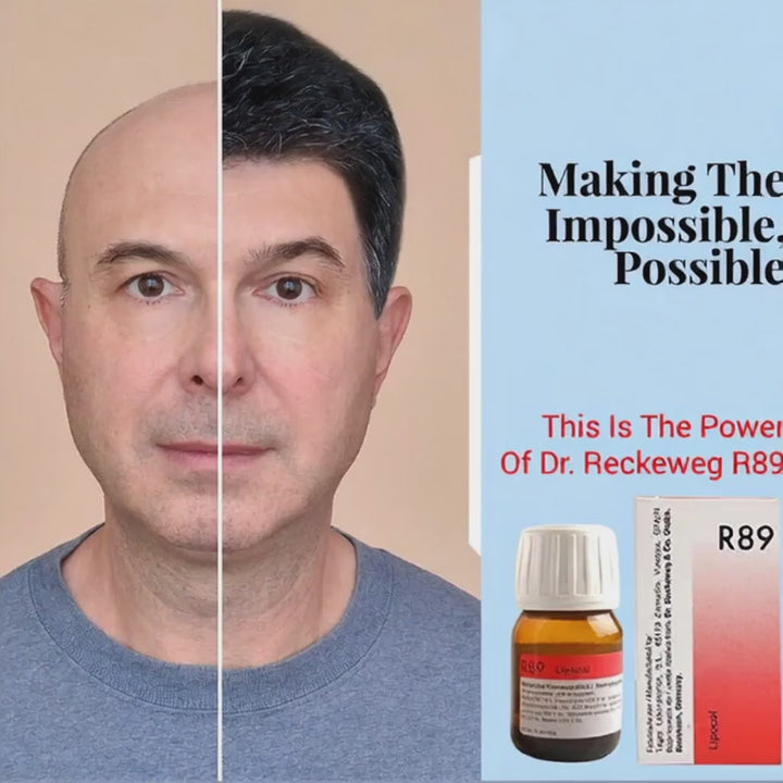 Dr. Reckeweg R89 Lipocol Drops Homeopathic Solution for Hair Loss, Grey Hair, 0.25 kg