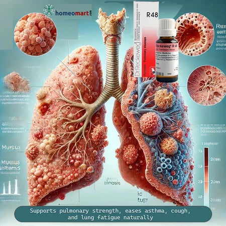 Dr. Reckeweg R48 Pulmonary Drops Lung Support for Asthma, Catarrh & Chronic Cough, 0.08 kg