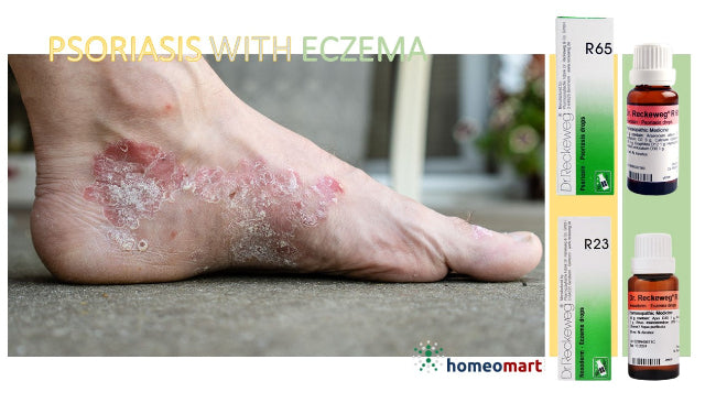Dr. Reckeweg R65 Drops - Homeopathy Relief for Psoriasis & Eczema, 0.10 kg