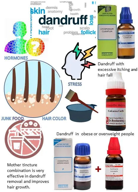Bakson's Dandruff Aid Tablets - Homeopathic Solution for Dandruff-Free Scalp, 0.08 kg