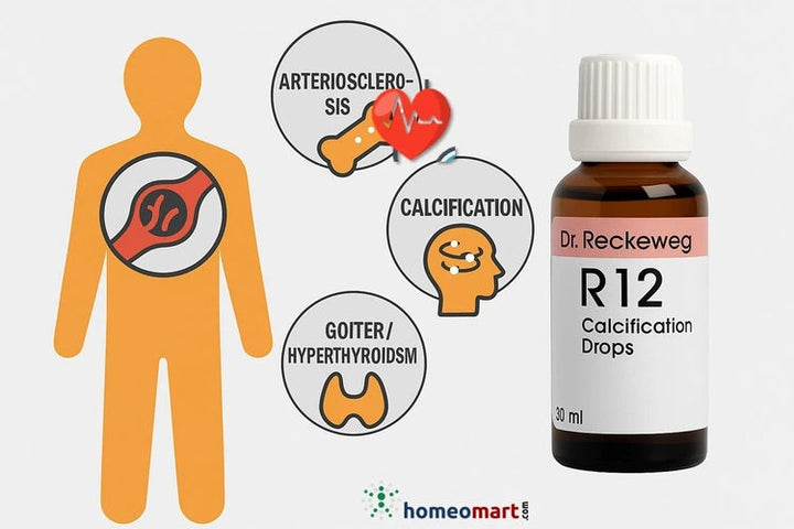 Dr. Reckeweg R12 Drops Relief from Arteriosclerosis, Calcification & Calcium Deposits, 0.10 kg