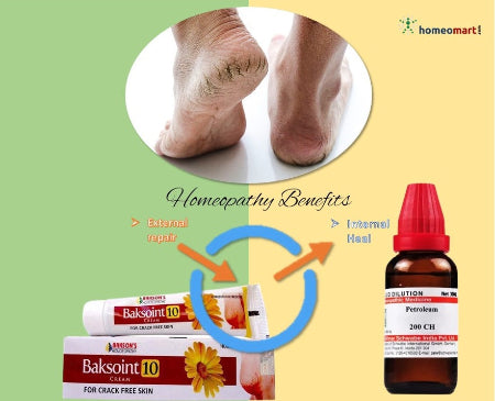 Bakson's Baksoint 10 Cream Heal and Protect Dry, Cracked Skin, 0.18 kg