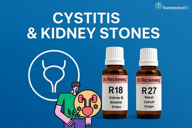 Dr. Reckeweg R27 Kidney Stone Drops - Homeopathy for Renal Calculi, 0.08 kg