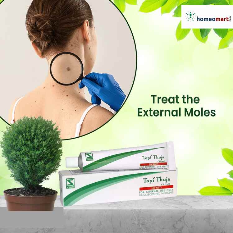 Effective Wart Removal with Schwabe Topi Thuja Cream, 0.08 kg